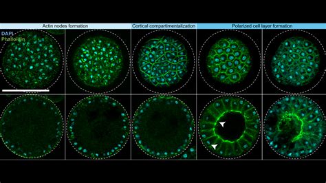  Dictyostelium!  A Fascinating Single-Celled Creature That Forms Multicellular Structures and Exhibits Cooperative Behavior