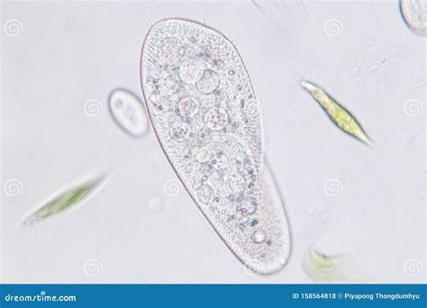  Genus Paramecium! A Closer Look at This Microscopic Marvel