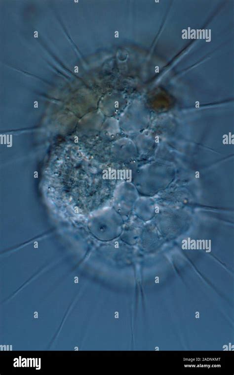  Weaver Amoeba: A Single-Celled Master Weaver With Intricate Cytoplasmic Threads!